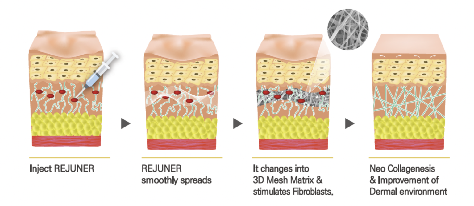 Rejuner Black PCL and PCL THREADS - Natural Kaos